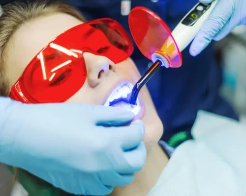 Laser Dentistry